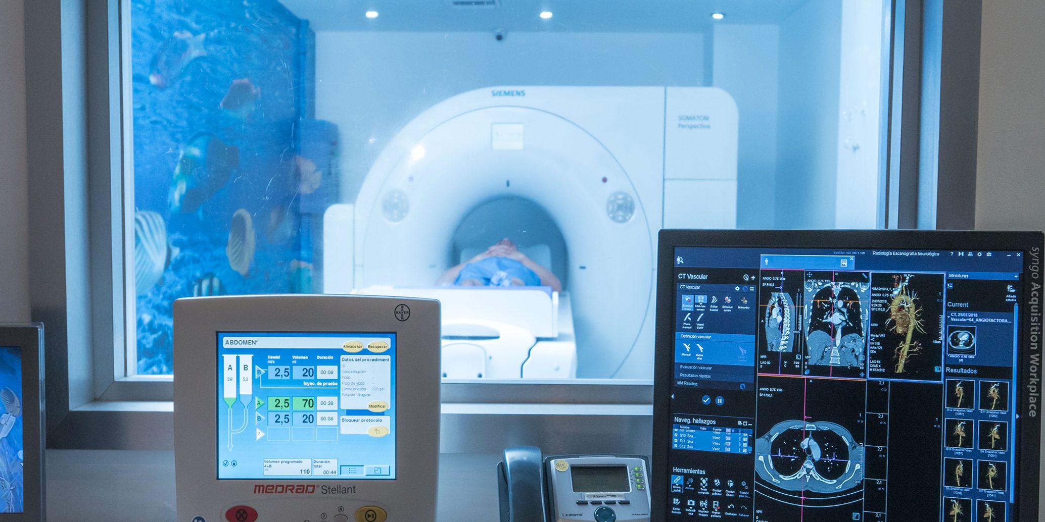 Tomografía | ESCANO