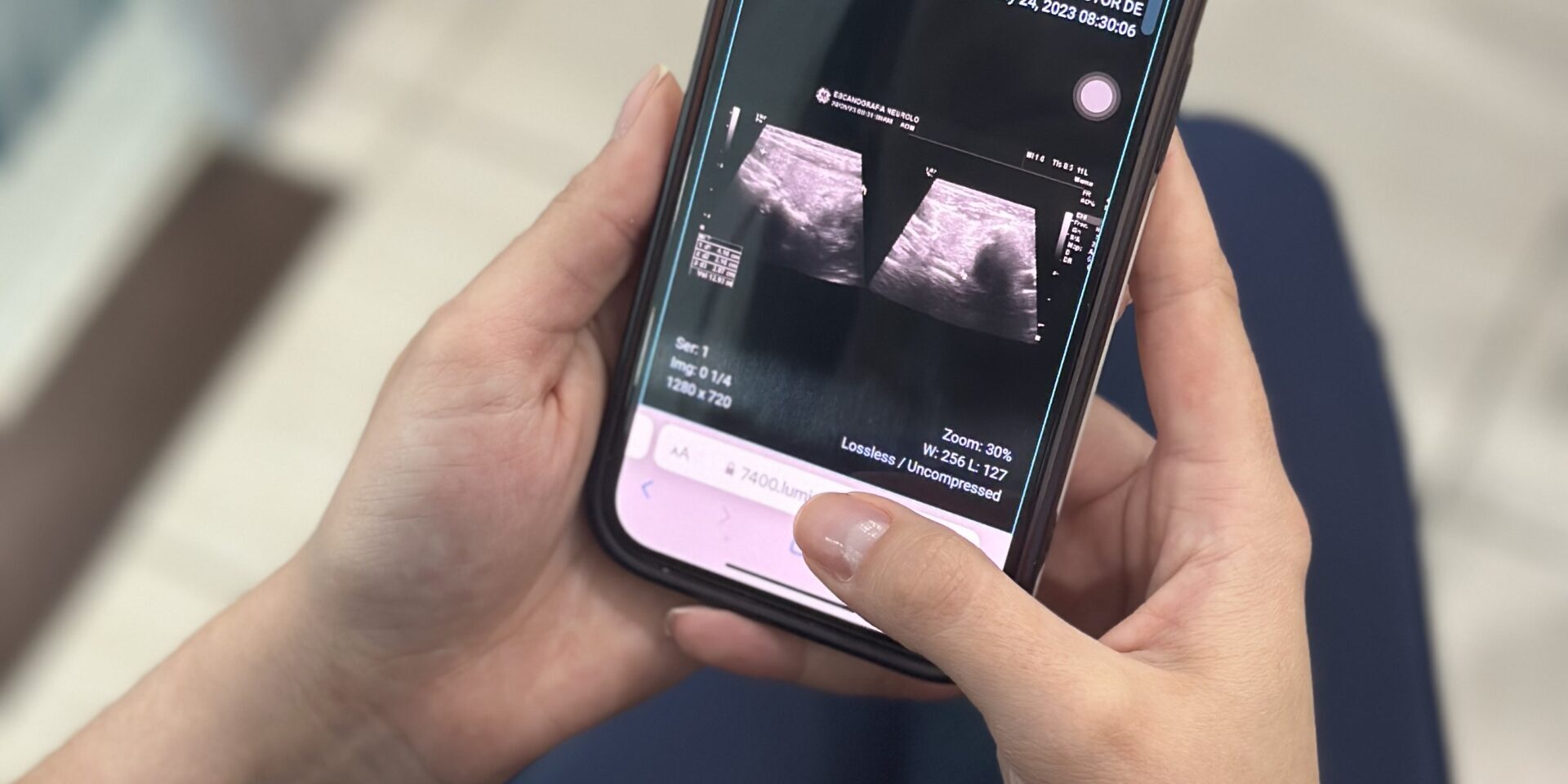 Foto Resultados | ESCANO