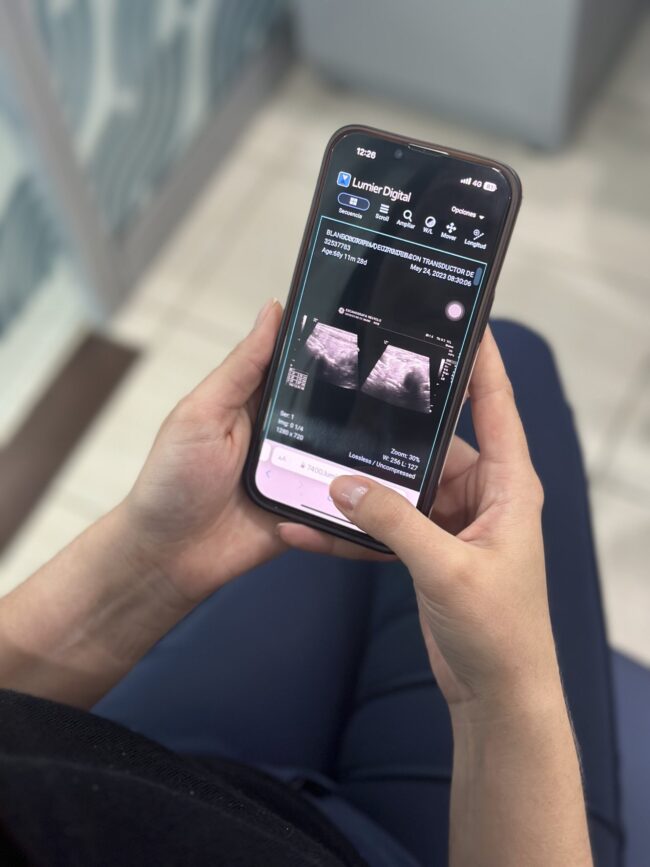 Foto Resultados | ESCANO Foto Resultados | ESCANO